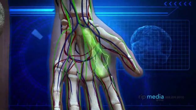 3D Medical Video